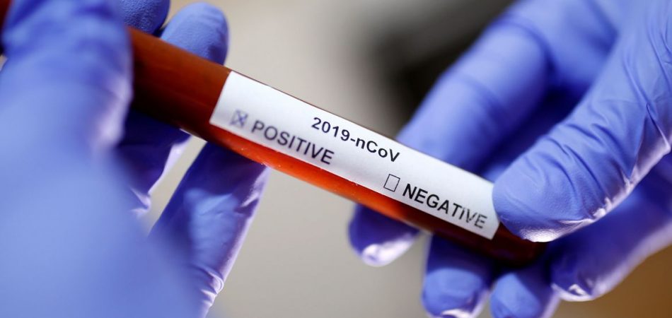 Nota Informativa Conjunta nº. 003/2020 – DIVE/LACEN/SUV/SES/SC – Atualizada